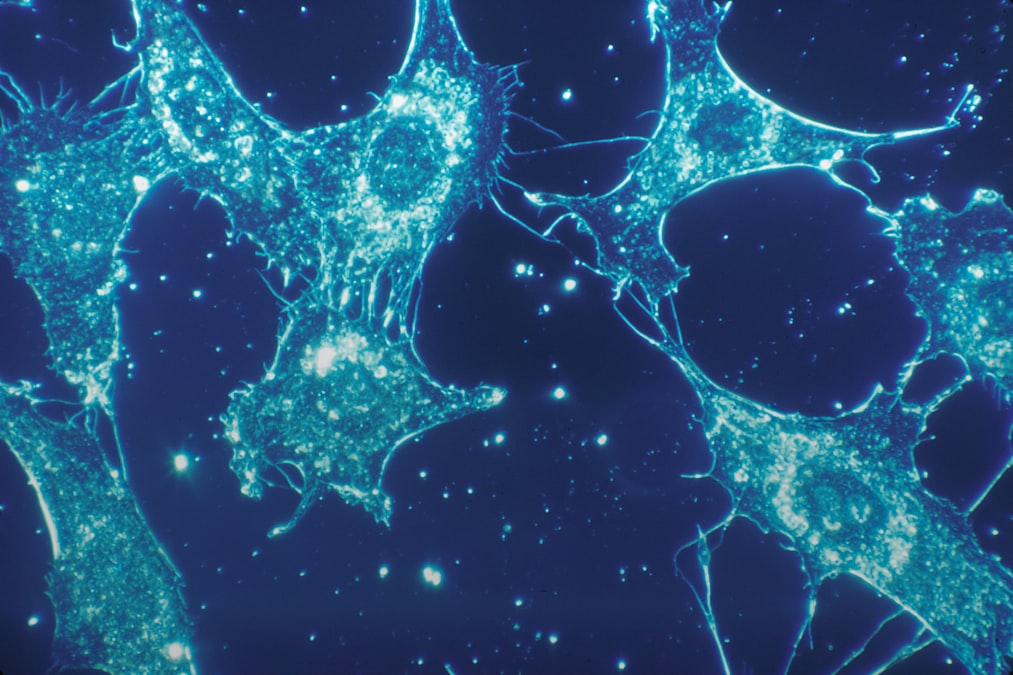 Fluorescent blue cells with irregular shapes against a dark background