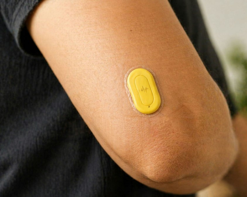 A yellow medical sensor attached to a person's arm